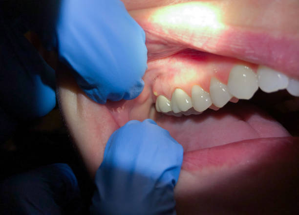 Best Weekend Emergency Dentist in Patrick Springs, VA