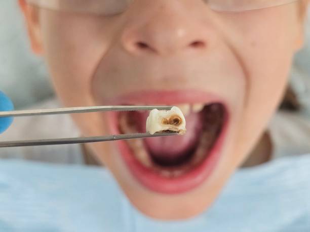 Best Emergency Gum Treatment in Patrick Springs, VA